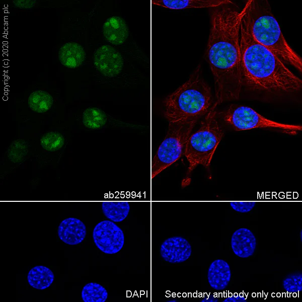 Immunocytochemistry/ Immunofluorescence - Anti-NSUN2/SAKI antibody [EPR24140-93] - BSA and Azide free (AB277534)