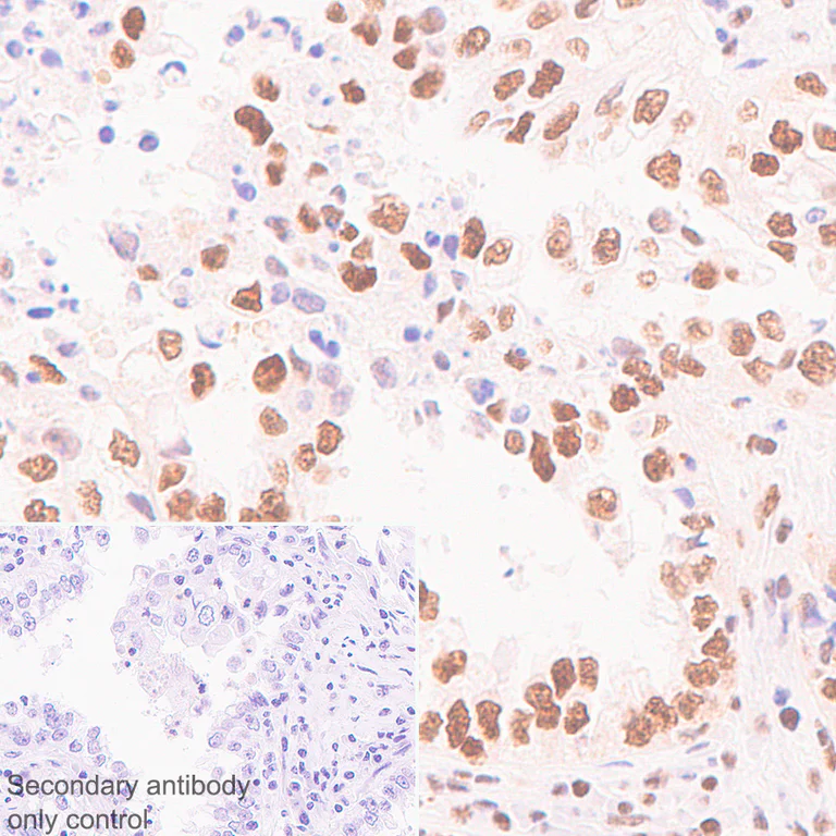 Immunohistochemistry (Formalin/PFA-fixed paraffin-embedded sections) - Anti-NSUN2/SAKI antibody [EPR24140-93] - BSA and Azide free (AB277534)