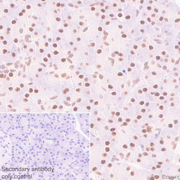 Immunohistochemistry (Formalin/PFA-fixed paraffin-embedded sections) - Anti-NSUN2/SAKI antibody [EPR24140-93] - BSA and Azide free (AB277534)