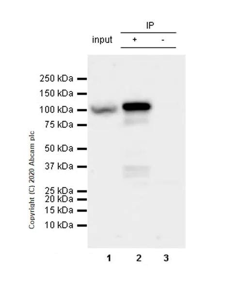 Immunoprecipitation - Anti-NSUN2/SAKI antibody [EPR24140-93] - BSA and Azide free (AB277534)