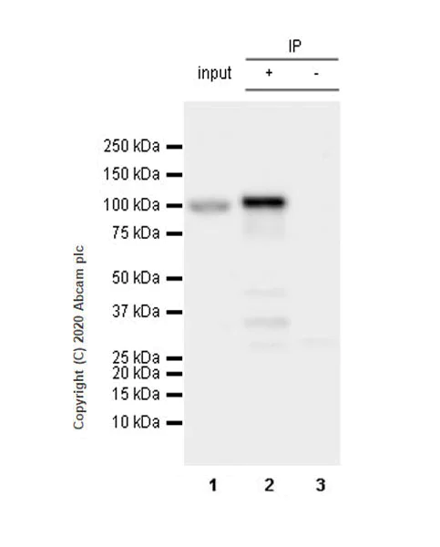 Immunoprecipitation - Anti-NSUN2/SAKI antibody [EPR24140-93] - BSA and Azide free (AB277534)