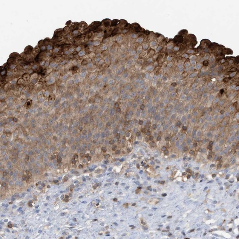Immunohistochemistry (Formalin/PFA-fixed paraffin-embedded sections) - Anti-NSUN3 antibody (AB272616), expandable thumbnail