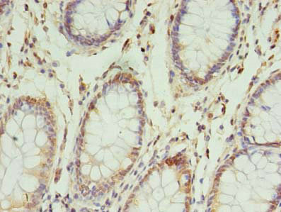 Immunohistochemistry (Formalin/PFA-fixed paraffin-embedded sections) - Anti-NSUN4 antibody (AB235430), expandable thumbnail