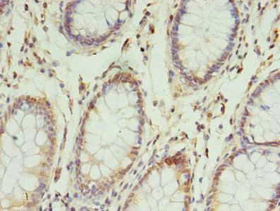 Immunohistochemistry (Formalin/PFA-fixed paraffin-embedded sections) - Anti-NSUN4 antibody (AB235430)
