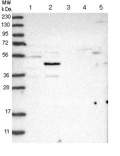 Western blot - Anti-NSUN5 antibody (AB121633)