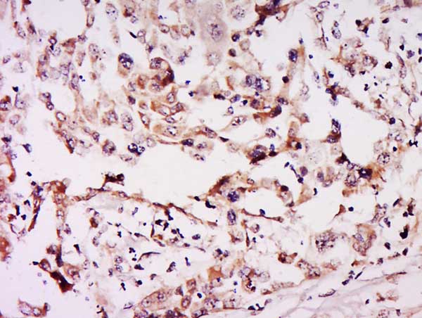 Immunohistochemistry (Formalin/PFA-fixed paraffin-embedded sections) - Anti-NSUN6 antibody (AB214227), expandable thumbnail
