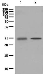 Western blot - Anti-NT-4 antibody [EPR9180] (AB150437)
