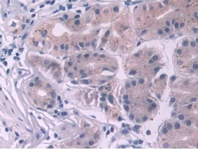 Immunohistochemistry (Formalin/PFA-fixed paraffin-embedded sections) - Anti-NT2NL antibody (AB233287)