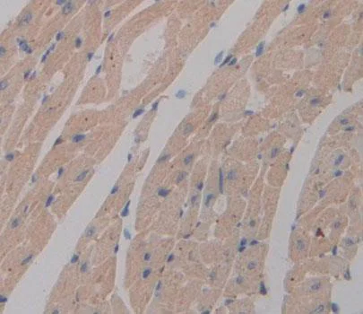 Immunohistochemistry (Formalin/PFA-fixed paraffin-embedded sections) - Anti-NT5C/dNT-1 antibody (AB231126)