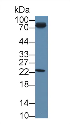 Western blot - Anti-NT5C/dNT-1 antibody (AB231126)
