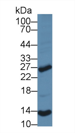 Western blot - Anti-NT5C/dNT-1 antibody (AB231126)