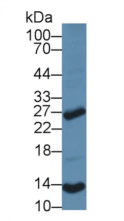 Western blot - Anti-NT5C/dNT-1 antibody (AB231126)