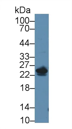 Western blot - Anti-NT5C/dNT-1 antibody (AB231126)