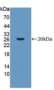 Western blot - Anti-NT5C/dNT-1 antibody (AB231126)