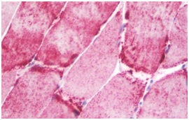 Immunohistochemistry (Formalin/PFA-fixed paraffin-embedded sections) - Anti-NT5C1A antibody (AB190214), expandable thumbnail