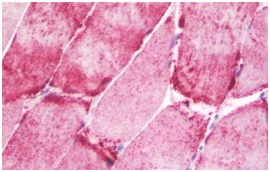 Immunohistochemistry (Formalin/PFA-fixed paraffin-embedded sections) - Anti-NT5C1A antibody (AB190214)
