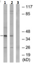 Western blot - Anti-NT5C1A antibody (AB190214), expandable thumbnail