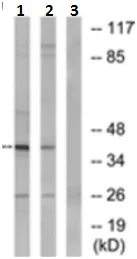 Western blot - Anti-NT5C1A antibody (AB190214)