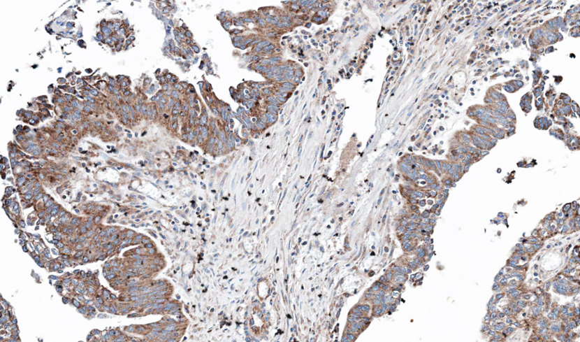 Immunohistochemistry (Formalin/PFA-fixed paraffin-embedded sections) - Anti-NT5C2 antibody (AB96084)