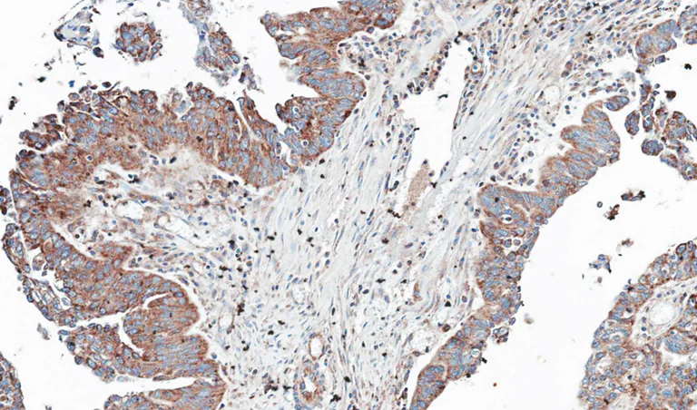 Immunohistochemistry (Formalin/PFA-fixed paraffin-embedded sections) - Anti-NT5C2 antibody (AB96084)