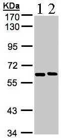 Western blot - Anti-NT5C2 antibody (AB96084)