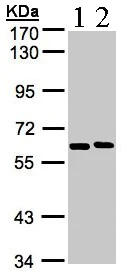 Western blot - Anti-NT5C2 antibody (AB96084)