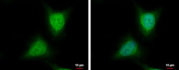 Immunocytochemistry/ Immunofluorescence - Anti-NTAQ1 antibody (AB229143)