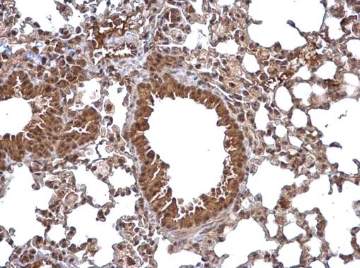 Immunohistochemistry (Formalin/PFA-fixed paraffin-embedded sections) - Anti-NTAQ1 antibody (AB229143)