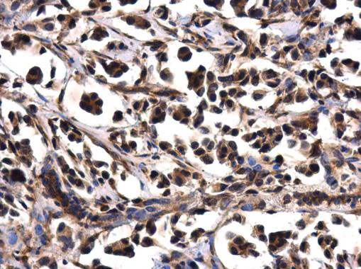 Immunohistochemistry (Formalin/PFA-fixed paraffin-embedded sections) - Anti-NTAQ1 antibody (AB229143)