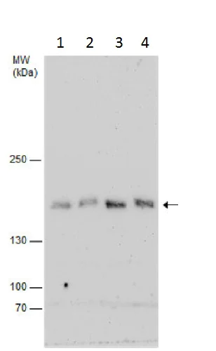 Western blot - Anti-NTE antibody - C-terminal (AB228683)