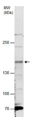 Western blot - Anti-NTE antibody - C-terminal (AB228683)