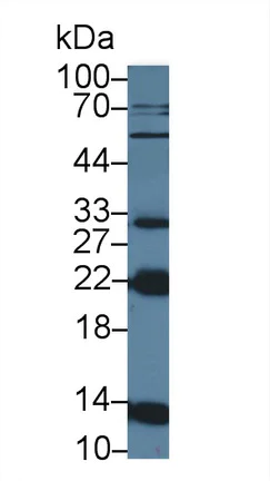 Western blot - Anti-NTF2 antibody (AB231185)