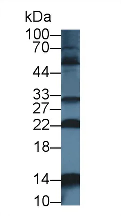 Western blot - Anti-NTF2 antibody (AB231185)