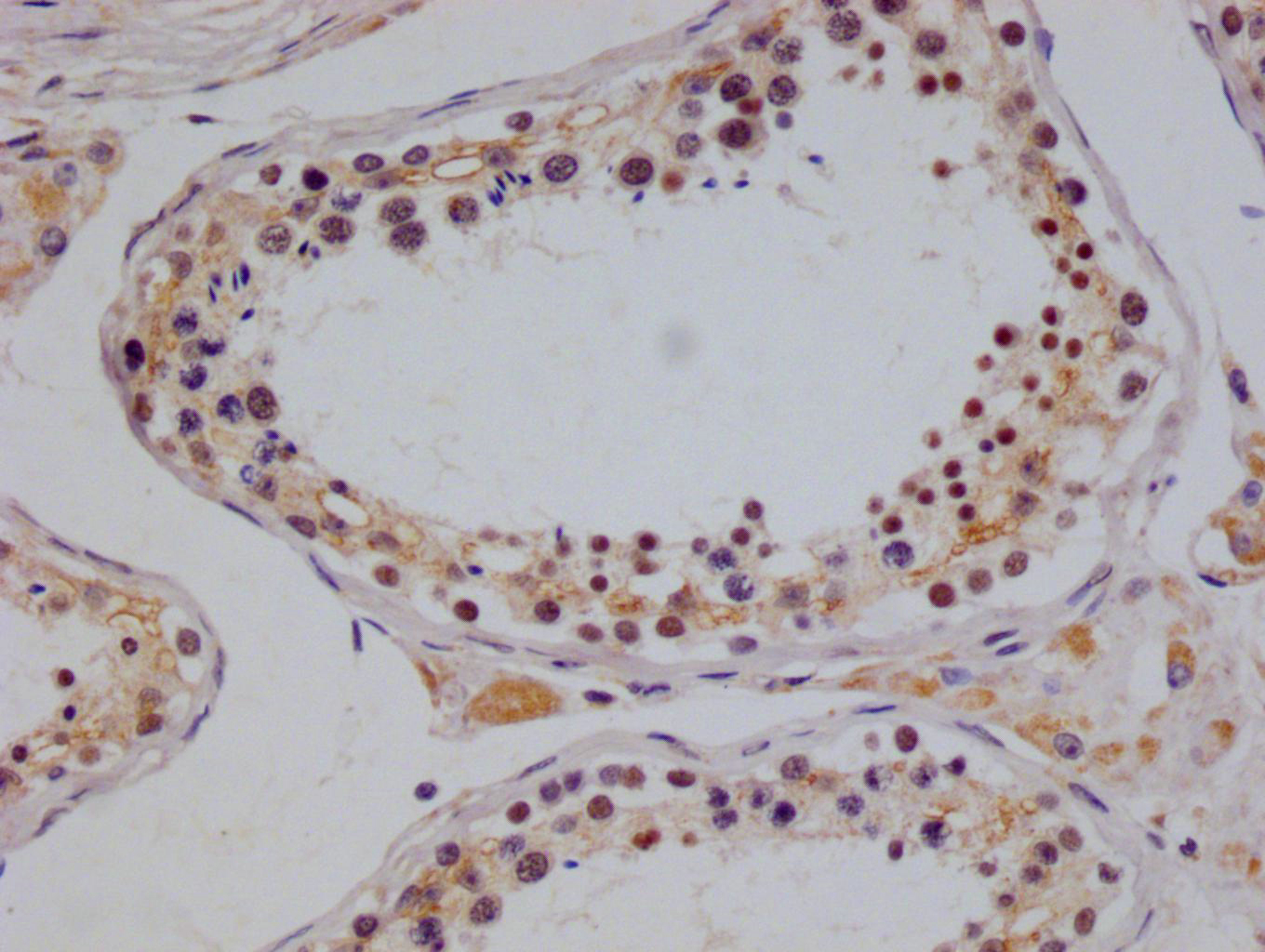 Immunohistochemistry (Formalin/PFA-fixed paraffin-embedded sections) - Anti-NTH1 antibody [22H10] (AB314192), expandable thumbnail