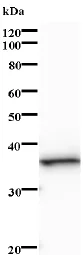Western blot - Anti-NTH1 antibody [2660C1a] (AB70726)
