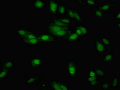 Immunocytochemistry/ Immunofluorescence - Anti-NTH1 antibody (AB236912)