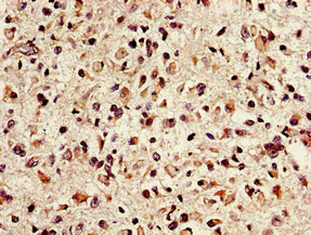 Immunohistochemistry (Formalin/PFA-fixed paraffin-embedded sections) - Anti-NTH1 antibody (AB236912)