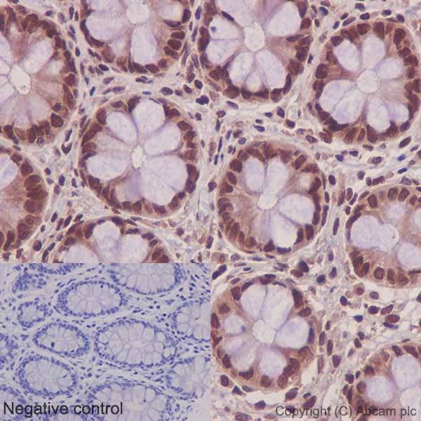 Immunohistochemistry (Formalin/PFA-fixed paraffin-embedded sections) - Anti-NTH1 antibody [EPR15930] (AB191413)