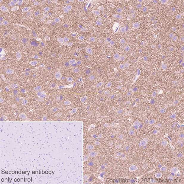 Immunohistochemistry (Formalin/PFA-fixed paraffin-embedded sections) - Anti-NTT4 antibody [EPR28520-13] - BSA and Azide free (ab313748), expandable thumbnail