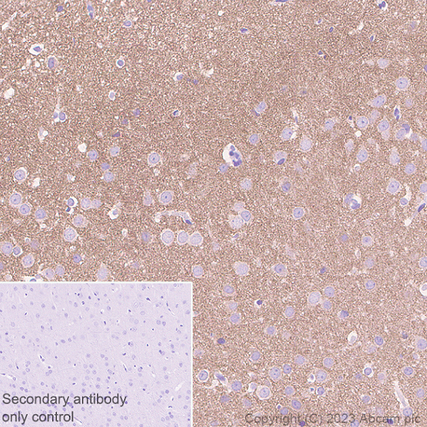 Immunohistochemistry (Formalin/PFA-fixed paraffin-embedded sections) - Anti-NTT4 antibody [EPR28520-13] - BSA and Azide free (ab313748), expandable thumbnail