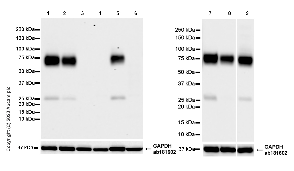 Western blot - Anti-NTT4 antibody [EPR28520-13] - BSA and Azide free (ab313748), expandable thumbnail