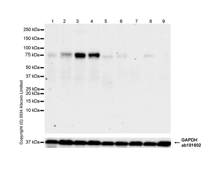 Western blot - Anti-NUAK1/ARK5 antibody [EPR28626-53] - BSA and Azide free (AB319149)