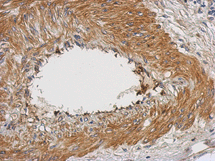 Immunohistochemistry (Formalin/PFA-fixed paraffin-embedded sections) - Anti-NUAK2 antibody (AB126048)