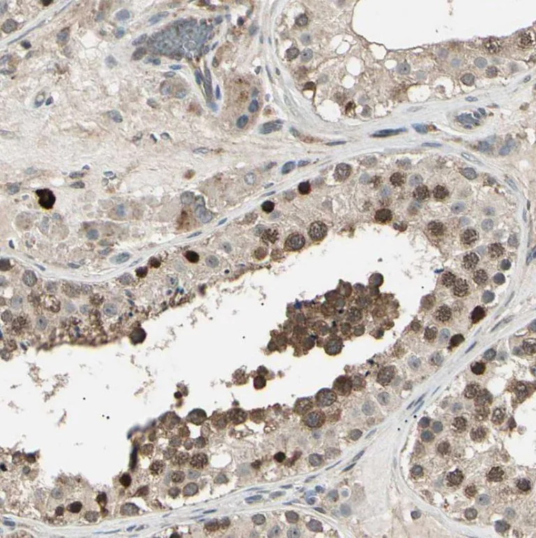 Immunohistochemistry (Formalin/PFA-fixed paraffin-embedded sections) - Anti-NUAK2 antibody (AB224079)