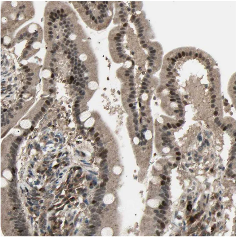 Immunohistochemistry (Formalin/PFA-fixed paraffin-embedded sections) - Anti-NUAK2 antibody (AB224079)