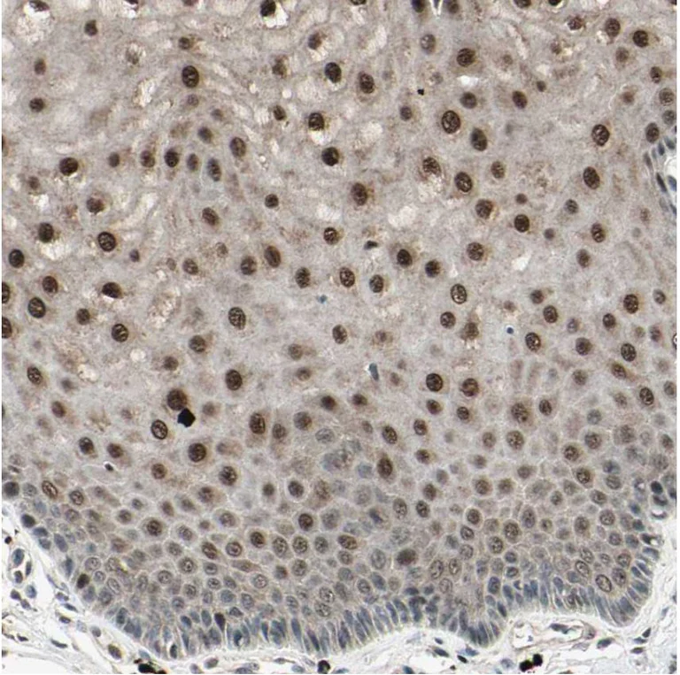 Immunohistochemistry (Formalin/PFA-fixed paraffin-embedded sections) - Anti-NUAK2 antibody (AB224079)