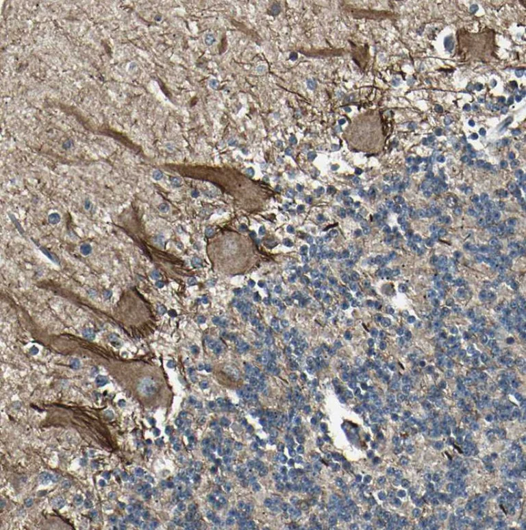 Immunohistochemistry (Formalin/PFA-fixed paraffin-embedded sections) - Anti-NUAK2 antibody (AB224079)