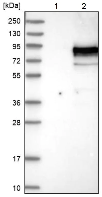 Western blot - Anti-NUAK2 antibody (AB224079)