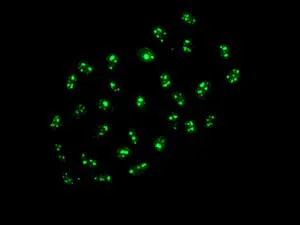 Immunocytochemistry/ Immunofluorescence - Anti-NUB1 antibody [EPR10716] (AB171077)