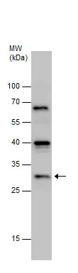 Western blot - Anti-NUBPL antibody (AB229670)